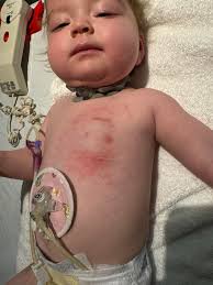 Poor care from Christchurch renal team