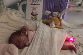 Baby Born At 23 Weeks Was The Size Of Mum S Hand And Weighed Just Over 1lb Mirror Online Over the next several weeks, your baby will really begin to fill. baby born at 23 weeks was the size of