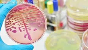 Definitions for sepsis and organ failure and guidelines for the use of innovative therapies in sepsis. Sepsi Diagnosi E Terapia Delle Gravi Infezioni Sistemiche Torrinomedica