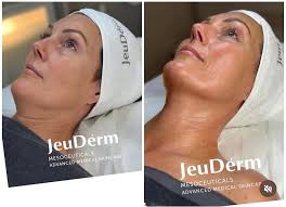 Äntligen kan ni boka in er på Avancerade Koreanska Ansiktsbehandlingar från  världsledande JEUDERM ! Behandlingen utförs av Sara som lärts upp av bästa  7hMedical! Finns två olika att boka , en lyx