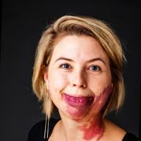 70+ “Rønsholt” profiler