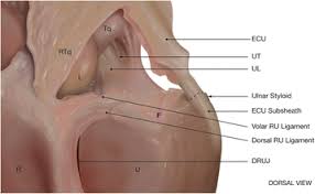 Patients with tfcc injury will present with. Open Versus Arthroscopic Repair Of The Triangular Fibrocartilage Complex A Systematic Review Journal Of Experimental Orthopaedics Full Text