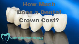 Jan 17, 2018 · veneers aren't often covered by insurance, as they're considered a cosmetic procedure. How Much Does A Dental Crown Cost Youtube