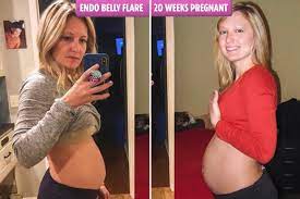 Specifically, using raw apple cider vinegar helps to increase levels of stomach acid, or hydrochloric acid. Women Share Photos Of Their Bloated Bellies To Show Painful Reality Of Living With Endometriosis