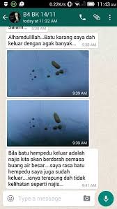 Sebaik sahaja batu sampai ke persimpangan di antara ureter dan pundi kencing, anda akan mula merasa sakit apabila anda membuang air kecil. Glamohealth Batu Karang 7 Ubat Batu Karang Pundi Kencing Hempedu Buah Pinggang Kidney Stone