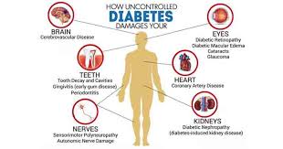 Symptoms of diabetes kidney disease. Can Diabetes Lead To Kidney Problem Timeslifestyle