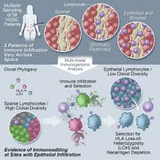A laparotomy is a procedure where the doctor opens the abdomen using a larger incision and is able to remove the ovaries. Interfaces Of Malignant And Immunologic Clonal Dynamics In Ovarian Cancer Sciencedirect