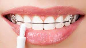 Biaya pengobatan gigi gratis menggunakan bpjs. Apakah Gigi Palsu Ditanggung Bpjs Tribun Pontianak