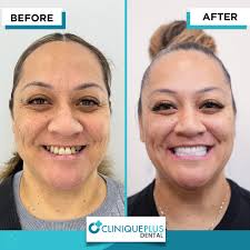 Transform Your Smile with Zirconium Crowns and Expert Care