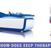 How Does EECP Therapy Work? | NexIn Health