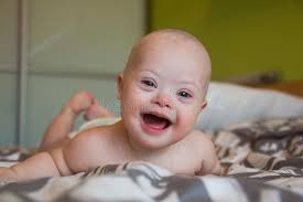 We did not find results for: 1 552 Syndrome Baby Photos Free Royalty Free Stock Photos From Dreamstime