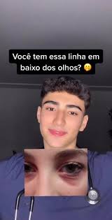 Linhas de Dennie-Morgan: Causas e Tratamentos