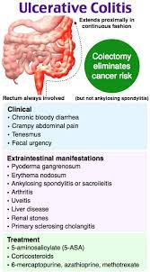Rosh Review Gastrointestinal Nursing Surgical Nursing Ulcerative Colitis