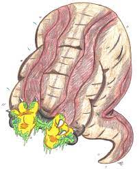 Malachi Vore: Swallowed by a Giant Leech by KnightRayjack -- Fur Affinity  [dot] net