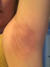 Omg The Natural Deodorant I Tried Burned My Armpits Almandine Wellness