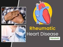 Rheumatic Heart Disease Causes Symptoms Diagnosis And Treatment