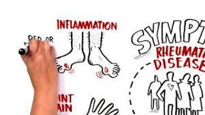 Rheumatology Specialty Center Rheumatic Disease Associates In Pa