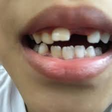 Klinik pergigian bandar tenggara is awesome. Top 10 Dental Clinic In Muar