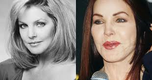What's it like to go from being unattractive to gorgeous? Celebrity Plastic Surgery Disasters Cbs News