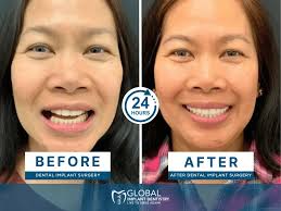 Global Implant Dentistry