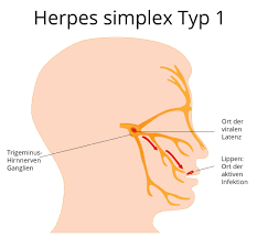 Dies geschieht zum beispiel während einer erkältung oder wenn man viel stress hat. Herpes Simplex Ansteckung Symptome Behandlung