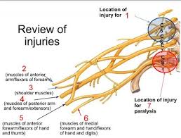 Brachial Plexus Flashcards Therapy Activities Brachial Physical Therapy