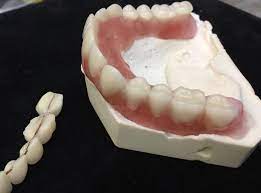 Diy Denture Affordable Denture At Home Denture Cosmetic Etsy Dental Casero Diy