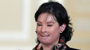 We did not find results for: Natalia Ponce De Leon La Mujer Que Se Convirtio En El Rostro De La Tragedia De Los Ataques Con Acido En Colombia Bbc News Mundo