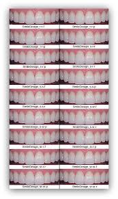 59 Comprehensive Tooth Crown Color Chart