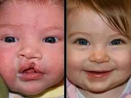 How many sturacture of the oral cavity???