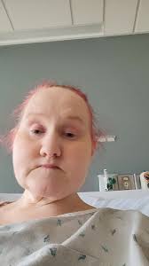 #legrehab, ##gastricbypassissues #hospitalstay