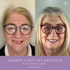 Amanda's Implant Makeover