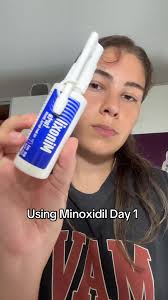 Using Minoxidil Day 1 , yes i started again #hairgrowthjourney #hairgr...