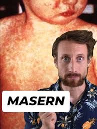 Masern sind 1 richtig besch💩 Krankheit. #masern #measles #vaccine #Im...