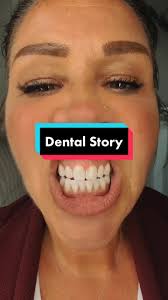 I also have a high palate and extra bone