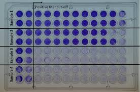 Image result for Neutralization Test