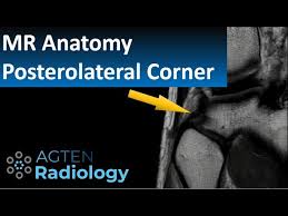 This long muscle flexes the knee. Ultimate Guide To Mr Anatomy Of The Posterolateral Corner In The Knee Youtube