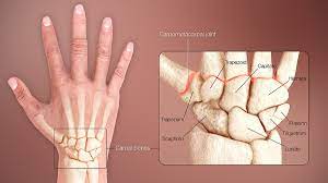It is strong enough to allow climbers to tackle any mountain, but also sufficiently precise for the manipulation of some of the world's smallest objects and the performance of complex actions. Carpal Bones Wikipedia