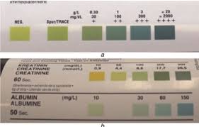 reference colours for the albustix and microalbustix urine