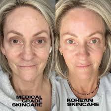 ✨ Ladies, let's talk about estrogen and skincare! 💁‍♀️ Did you know that  estrogen plays a crucial role in keeping our skin hydrated, maintaining  collagen and elastin levels, and preserving skin thickness?