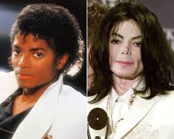 Michael Jackson antes e depois. A primeira foto é da década de 80, a  segundo foi tirada em 2001.