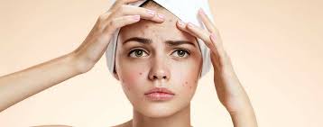 Dermatoloji Sivilce Akne Istanbul Cerrahi