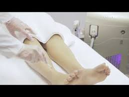 Burns, permanent changes to your skin color, and scars can occur. Advanced Laser Clinic About Regina Saskatoon Permanent Laser Hair Removal