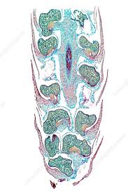 Image result for Lycopodium