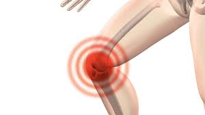 Arthrose Im Knie Behandlung Mit Hyaluronsaure Und Prp