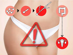 Image result for Candidiasis