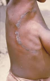 Red, itchy, scaly or oily rash; What S My Rash Pictures And Descriptions Of 21 Rash Types Plushcare