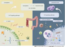 Image result for Constipation in Cancer