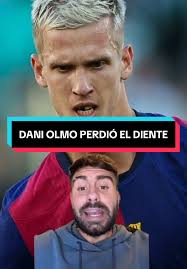 Dani Olmo Lost His Teeth