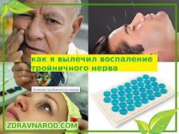 как лечить воспаление тройничного лицевого нерва в домашних условиях Kak Ya Vylechil Trojnichnyj Nerv Youtube